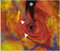 Technology Gives 3-D View of Human Coronary Arteries (2 of 2)