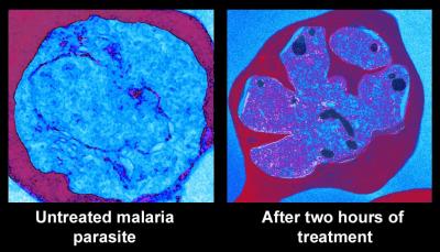 New Malaria Drugs Kill by Promoting Premature Parasite Division