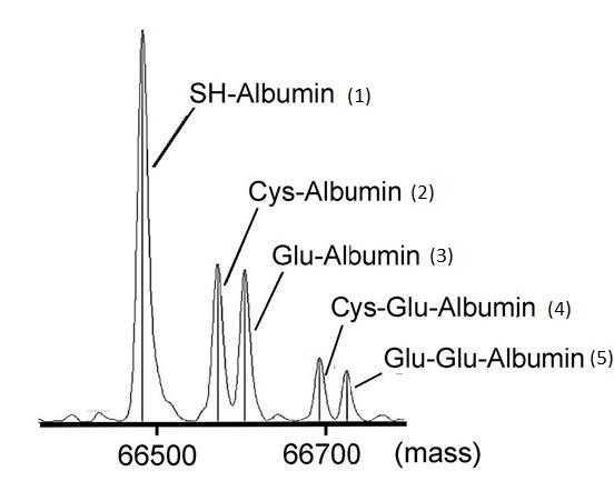 Measurement peak of post-translational modifier of serum albumin in diabetic patients