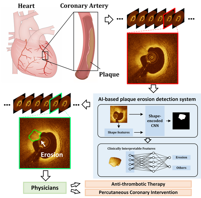 AI-based Image Analysis Automatically Detects | EurekAlert!