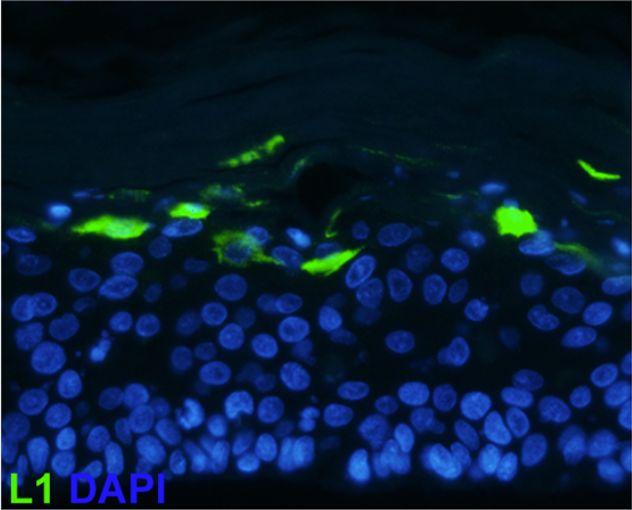 Scientists Design New Skin Cell Culture Technique to Study Human Papillomavirus