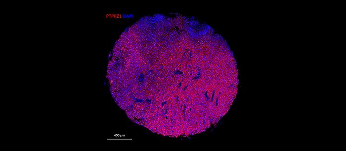 Programming cells to target brain tumours