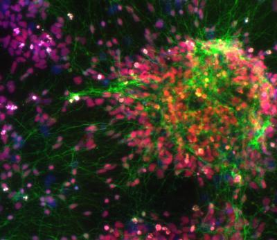 Nuclei from Human Cells and Stem-cell Derived Neurons