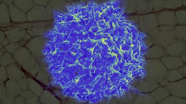 Blocking Immune Cell Treats New Type of Age-Related Diabetes