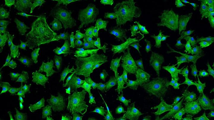 COVID and Cardiosphere-Derived Cells