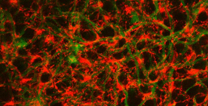 Muller Glia and Horizontal Cells in Zebrafish Retina