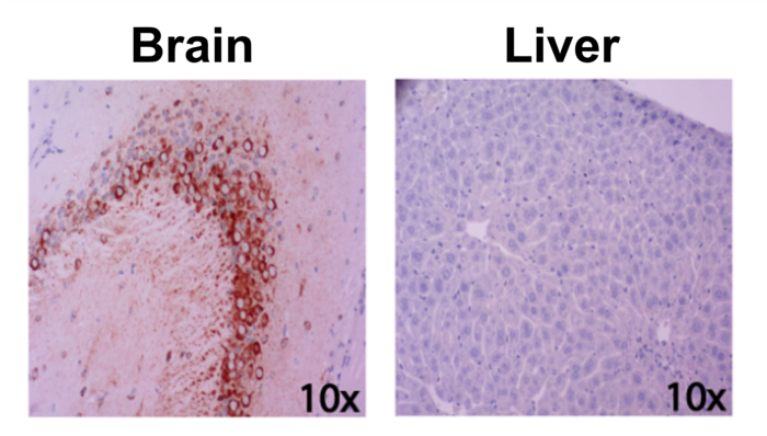 Rift Valley Fever Virus in the brain