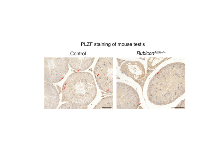 Figure 2. Rubicon<sup>Amh–/–</sup> mice exhibit a decrease in the number of spermatogonial stem cells