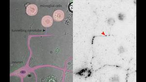 Live imaging of tunnelling nanotubes