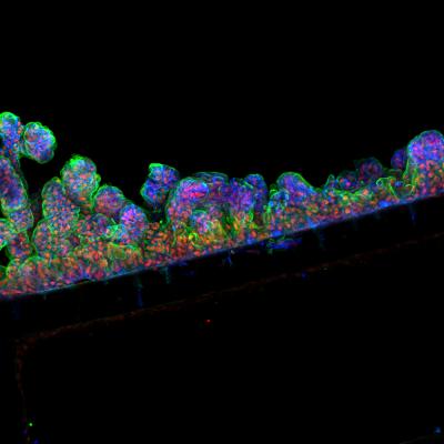Cells of Human Intestinal Lining in Intestine-Chip