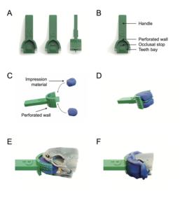 How the dental mold works