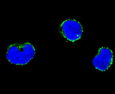 Big Steps for Mini-Genes in Muscular Dystrophy (3 of 6)