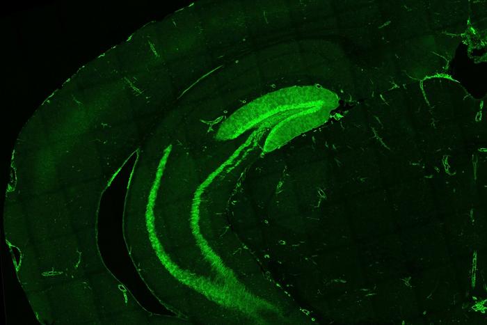 IL-1R1 Helps Neurons to  Directly Communicate with the Immune System