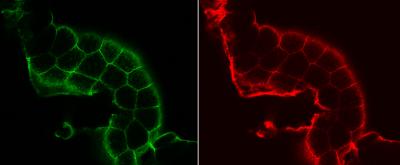 Fruit Fly Study Reveals How Cells Transport Sugar