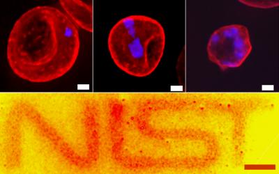 Nanoparticles for Medical Imaging