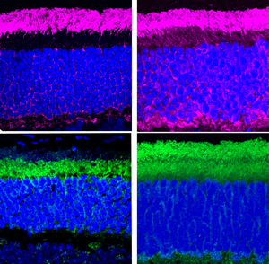 Usher syndrome photoreceptors