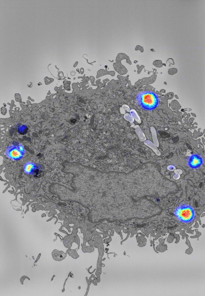 TB Antibiotic Visualisation