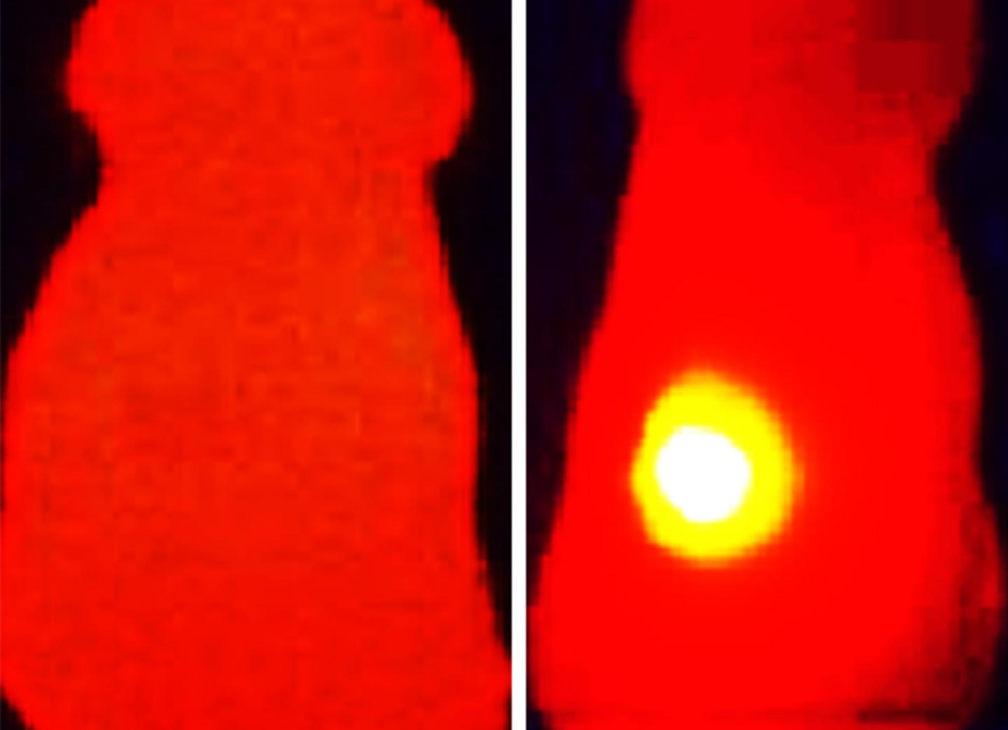 Infrared Thermal Images