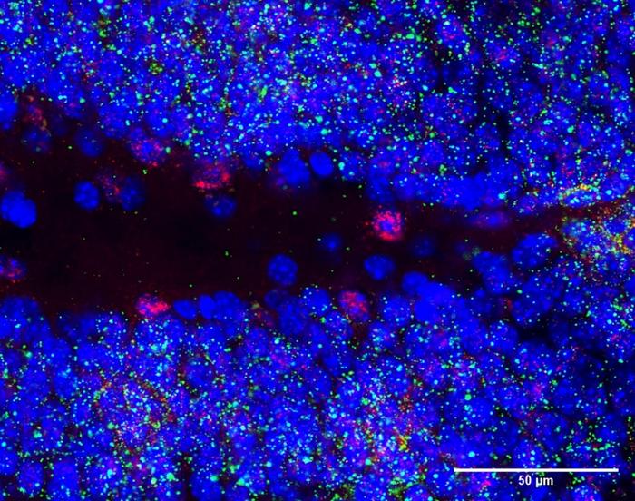 SNHG11 expression in the hippocampus