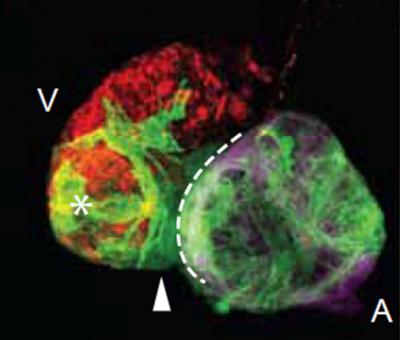 Cells Cardiac Regeneration