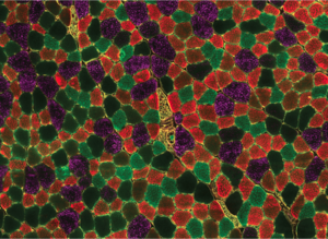 Staining of a skeletal muscle cross-section showing different types of muscle fiber in young mice