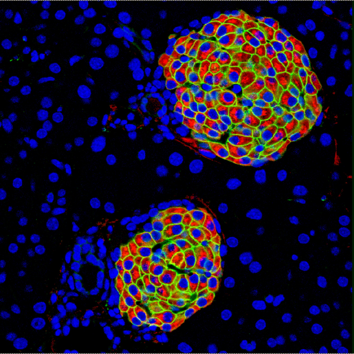 Cross-section of pancreatic cells showing insulin