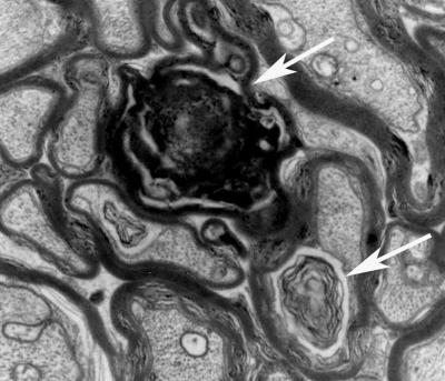 Cross Section of a Nerve from An Alzheimer’s Model Mouse
