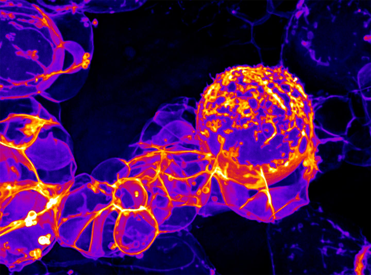 Drosophila neuron formation