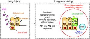 : Investigators analyzed a series of autopsies from patients with COVID-19 with late-stage lung disease at least 27 to 51 days after initial viral infection