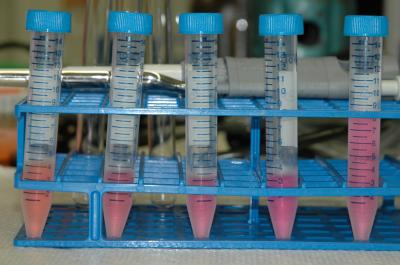 Research Shows Brazilian Acai Berry Antioxidants Absorbed by Human Body (3 of 3)