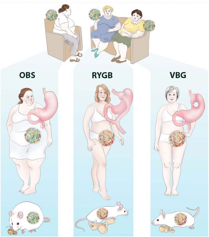 Bariatric Surgery Durably Alters the Human Gut Microbiome