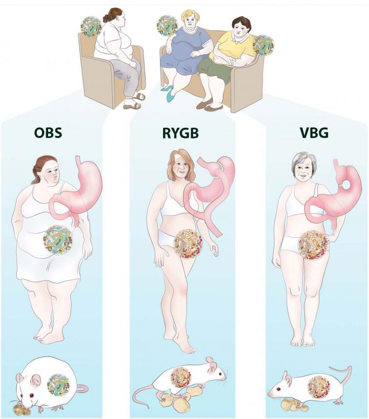 vertical banded gastroplasty before and after