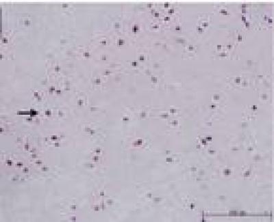 Sevoflurane Preconditioning