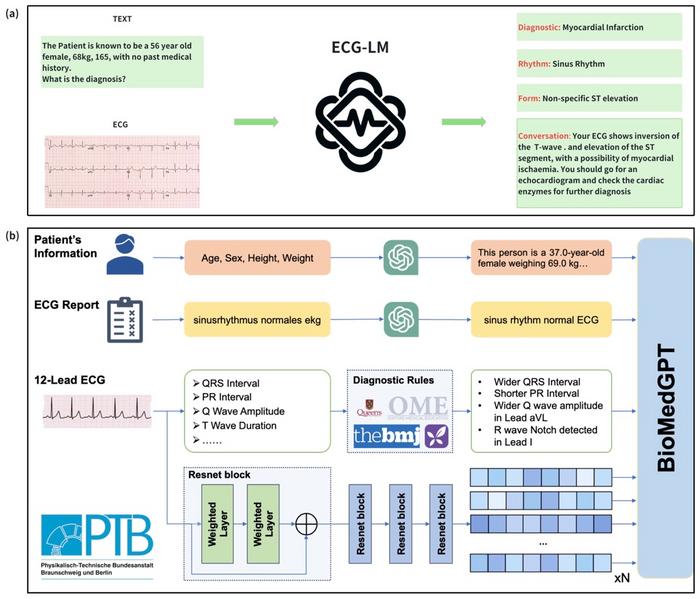 ECG-LM Framework