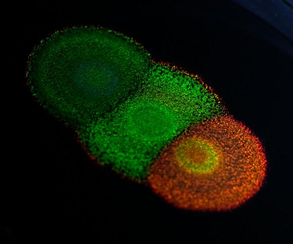 Flavobacterium