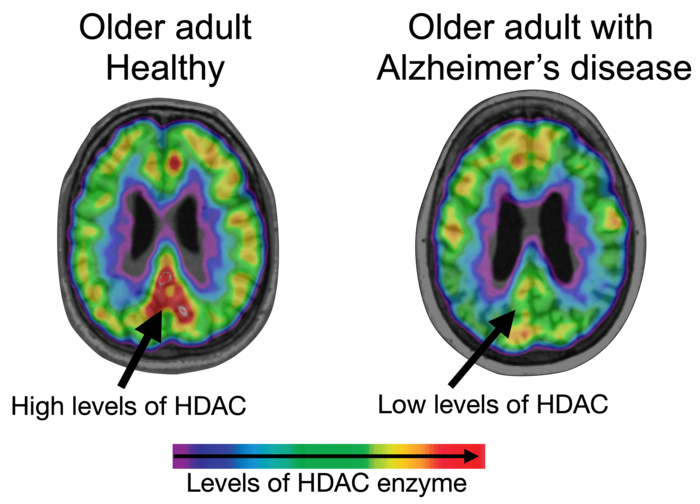 HDAC levels in the brain
