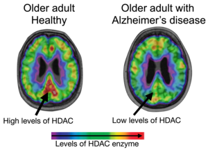 HDAC levels in the brain