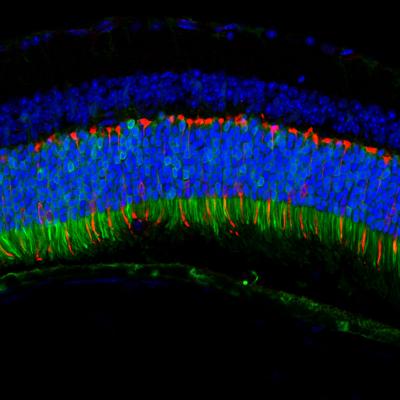 Retina Targeting by Anc-80