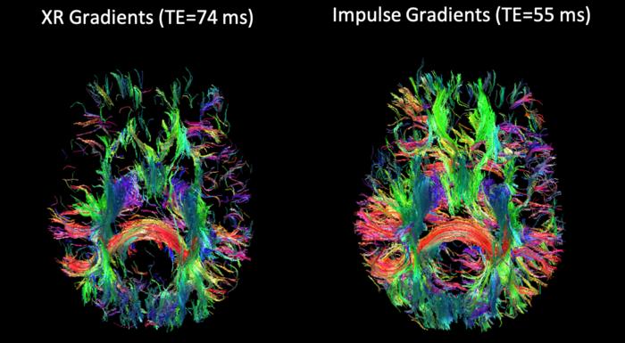 NexGen 7T brain scanner allows for detailed tractography