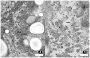 Comparison of anterior midgut ultrastructure in soybean cyst nematode (SCN)