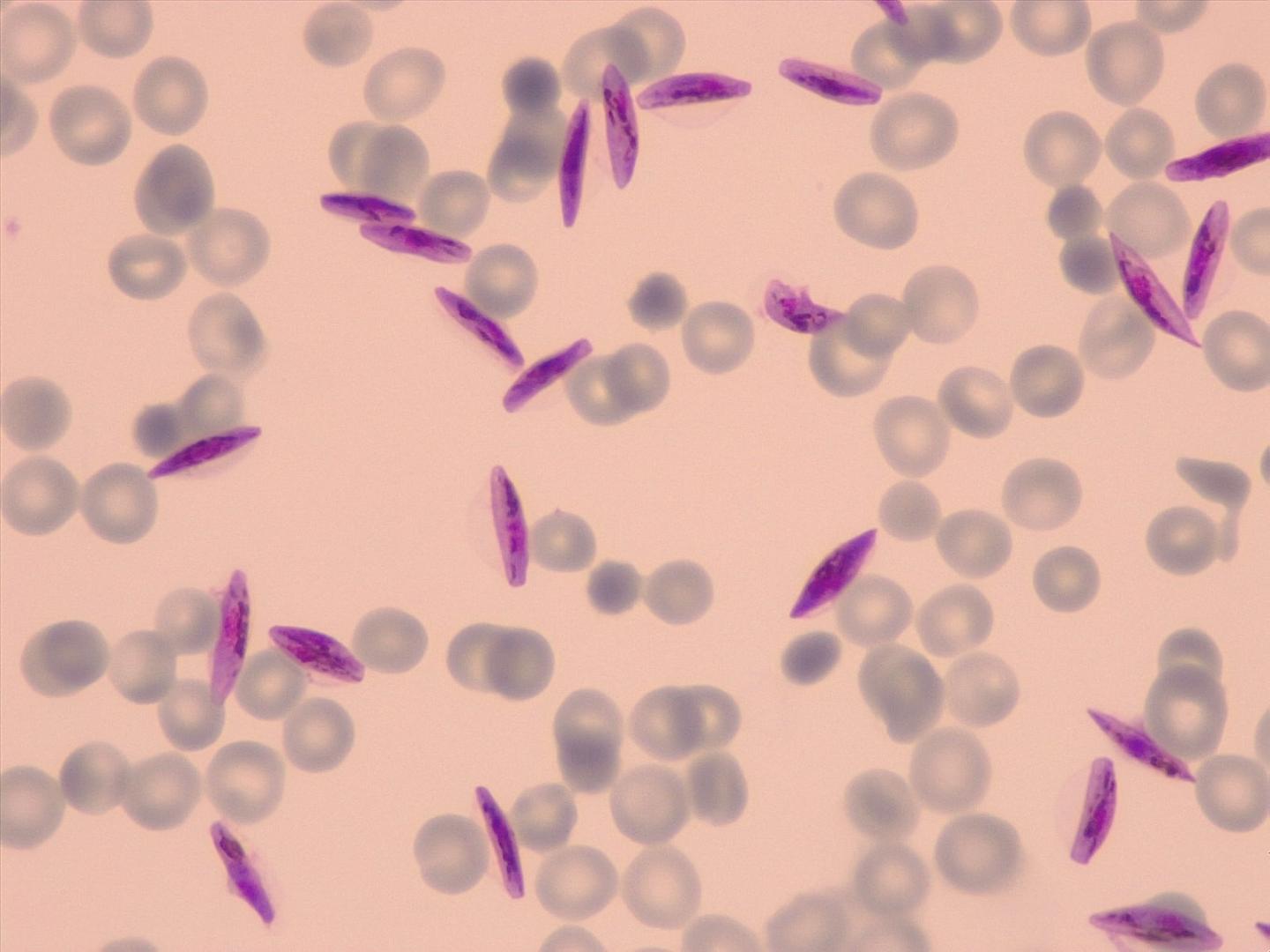 Gametocytes