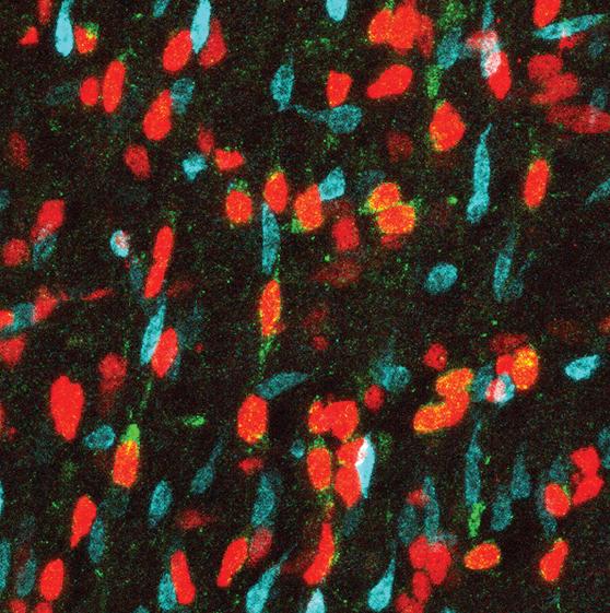 AXL in Developing Human Brain