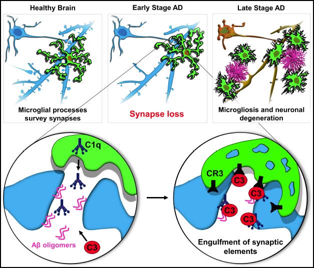 Model of Synapse Loss in Pre-Plaque Alzheimer Brain