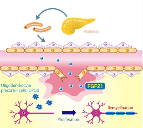 Figure 1. Remyelination