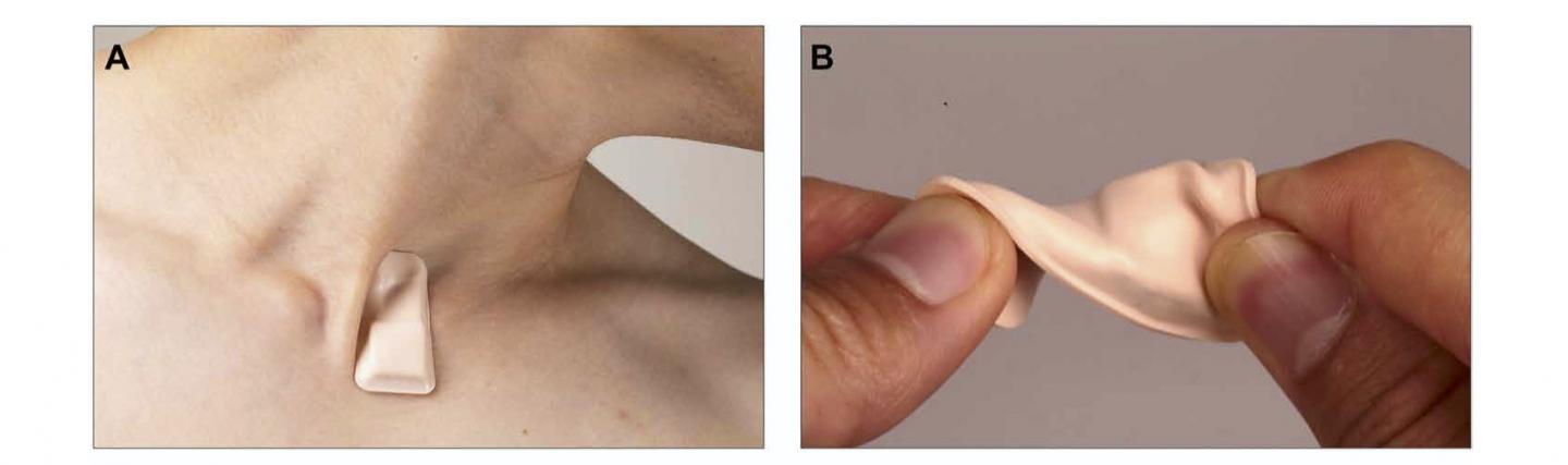 Wireless, soft, skin-interfaced sensor.