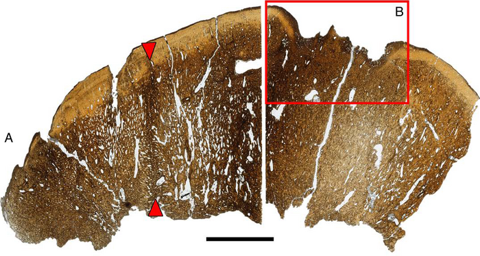 Thin section through dinosaur dome, showing healed injury