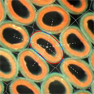 Computer analysis of deformation