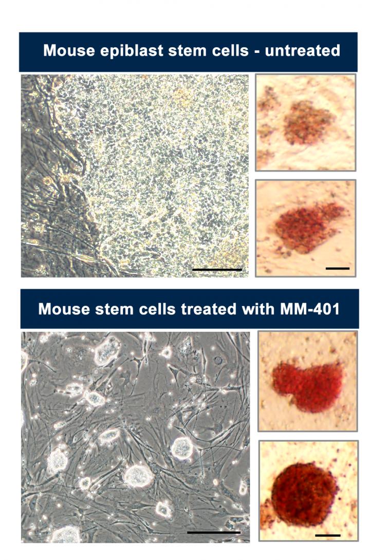 Stem Cells Before and After Treatment