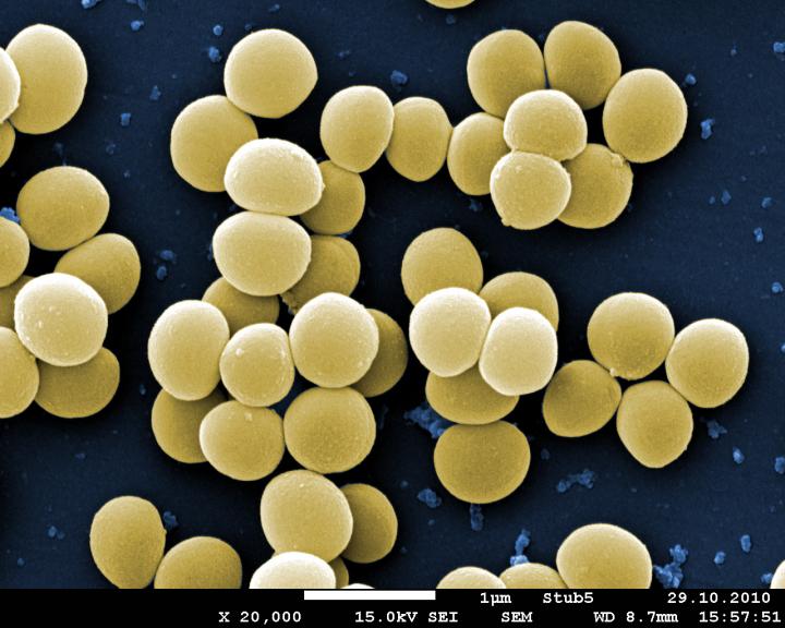 Staphylococcus aureus 