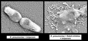 Klebsiella pneumoniae before and after treatment